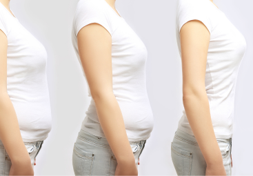 Trends plastische chirurgie 2026: impact van afslankmedicatie