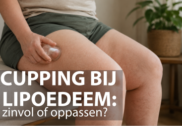 Cupping bij lipoedeem: werking, risico’s en aandachtspunten